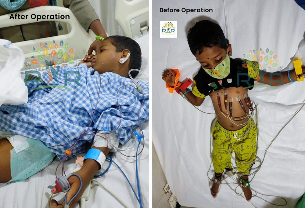 Heart Operation of 4 year old Rishvika - RAR Charitable Trust